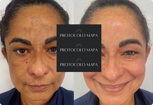 Copia-de-passe-para-o-lado-e-v-eja-a-transformacao-Post-para-Instagram-45-14.png